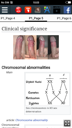 Male reproductive system screenshot 5