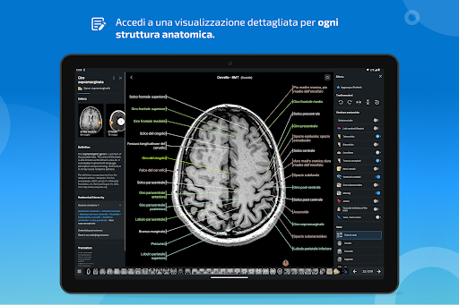 e-Anatomy screenshot 13