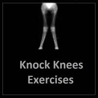 Knock Knees Exercises on 9Apps