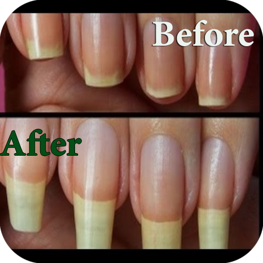 تطويل الاظافر بسرعه icon