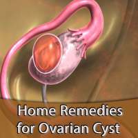 Home Remedies for Ovarian Cyst on 9Apps