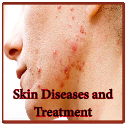 All Skin Diseases and Treatment icon