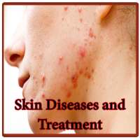 All Skin Diseases and Treatment on 9Apps