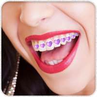 Teeth Braces Photo Booth on 9Apps