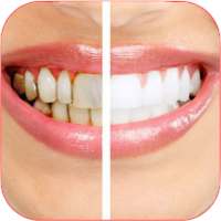 Home Remedies for Receding Gum. on 9Apps