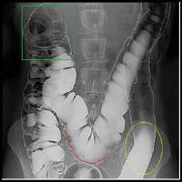 Aparato digestivo en preguntas