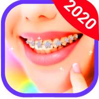 Braces Camera 2020 : Best  Braces  Editor of 2020 on 9Apps