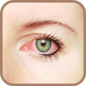 How to remove red eyes icon