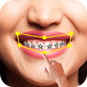 Braces Pro icon