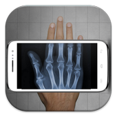 Xray Scan Prank icon