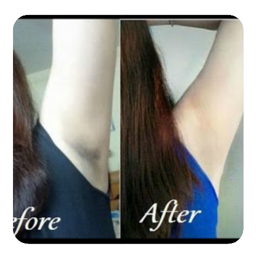 tips to get rid of dark armpits naturally icon