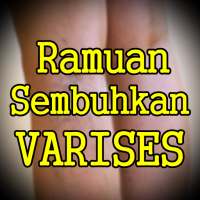 Ramuan Rumahan untuk Mengatasi Varises on 9Apps