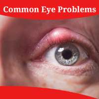 Common Eye Problems