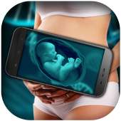Xray Scanner Pregnant Prank on 9Apps