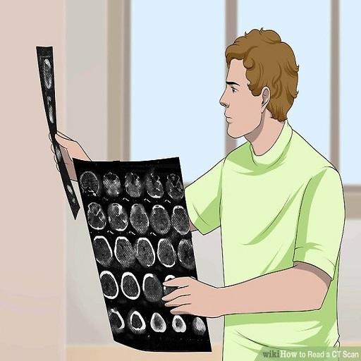 CT Brain Interpretation icon