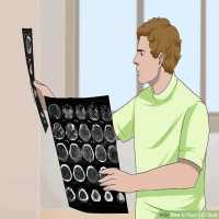 CT Brain Interpretation on 9Apps