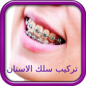 تركيب الاسنان - تقويم الأسنان أيقونة