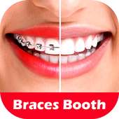 Braces Photo Editor 2018