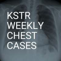 KSTR Weekly Chest Cases