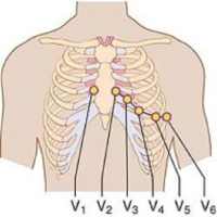 Clinical ECG Guide.