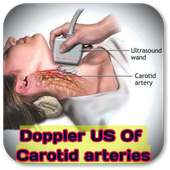 Doppler Ultrasound Of Carotid arteries on 9Apps