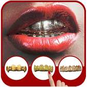 Gold Teeth Grillz