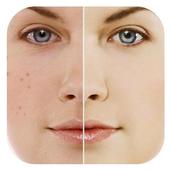 Photo Editor Blemish icon