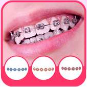 Real Braces teeth on 9Apps