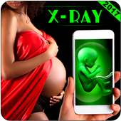 Pregnant Ultrasound Scan Prank on 9Apps