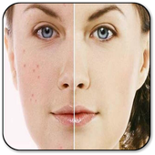 Have an Acne Free Face أيقونة