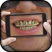 Gold Teeth Photo Editor on 9Apps