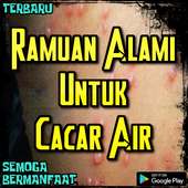 Ramuan Alami Untuk Cacar Air