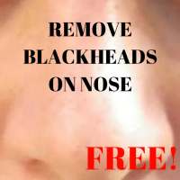 Remove Blackheads On Nose on 9Apps