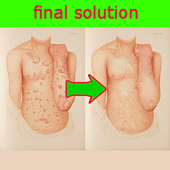 psoriasis solution icon