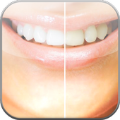 Teeth Whitener Photo Edit Tips icon