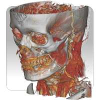 DroidRender - 3D DICOM viewer