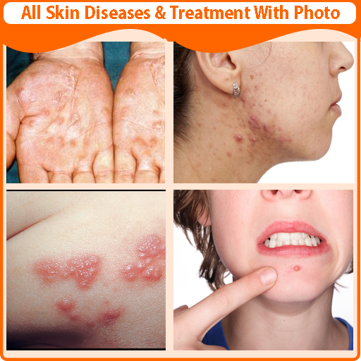 All Skin Diseases and Treatment icon