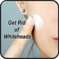 Get Rid Of Whiteheads on 9Apps