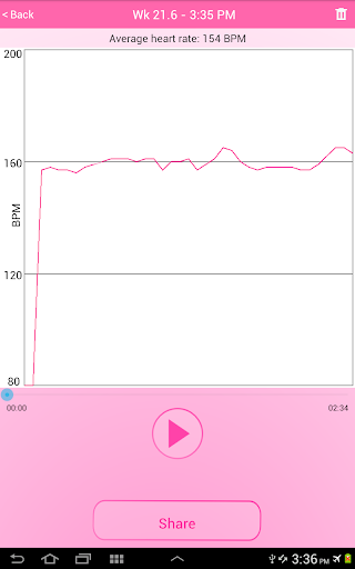 Fetal Doppler UnbornHeart screenshot 9
