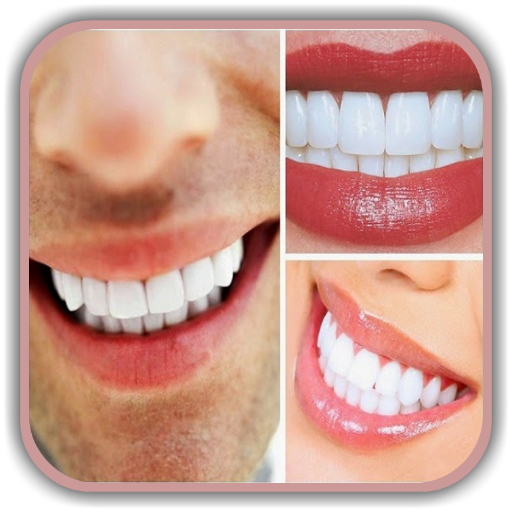 Teeth Whitening Tips: How to Remove Teeth Stains icon