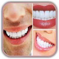 Teeth Whitening Tips: How to Remove Teeth Stains on 9Apps