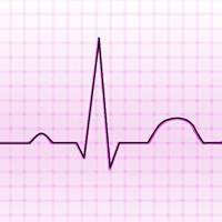 Electrocardiograma ECG Tipos