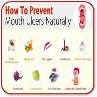 Prevent Mouth Ulcer Nature