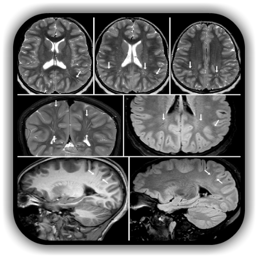 Imaging Brain, Skull &amp; Craniocervical Vasculature icon