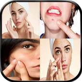 أفضل الوصفات لإزالة حب الشباب on 9Apps