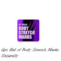 Get Rid of Body Stretch Marks Naturally on 9Apps