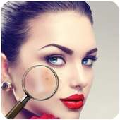 Pimple Remover on 9Apps