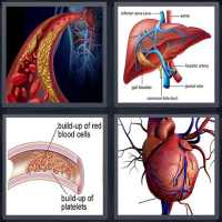 Blood Disease & Treatment