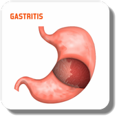 Treat Gastritis icon
