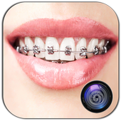 Braces Photo Editor Beauty icon